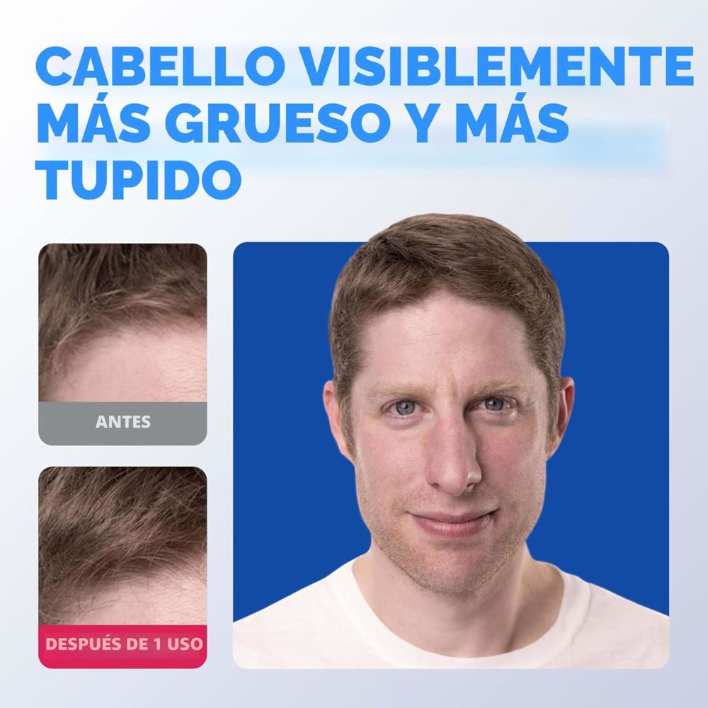 Shampoo Engrosador 2 en 1 para Hombre Rogaine 248 mL – Cabello más abundante desde el primer lavado - Imagen 4